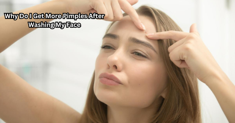 Why Do I Get More Pimples After Washing My Face