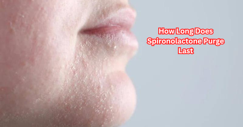 How Long Does Spironolactone Purge Last